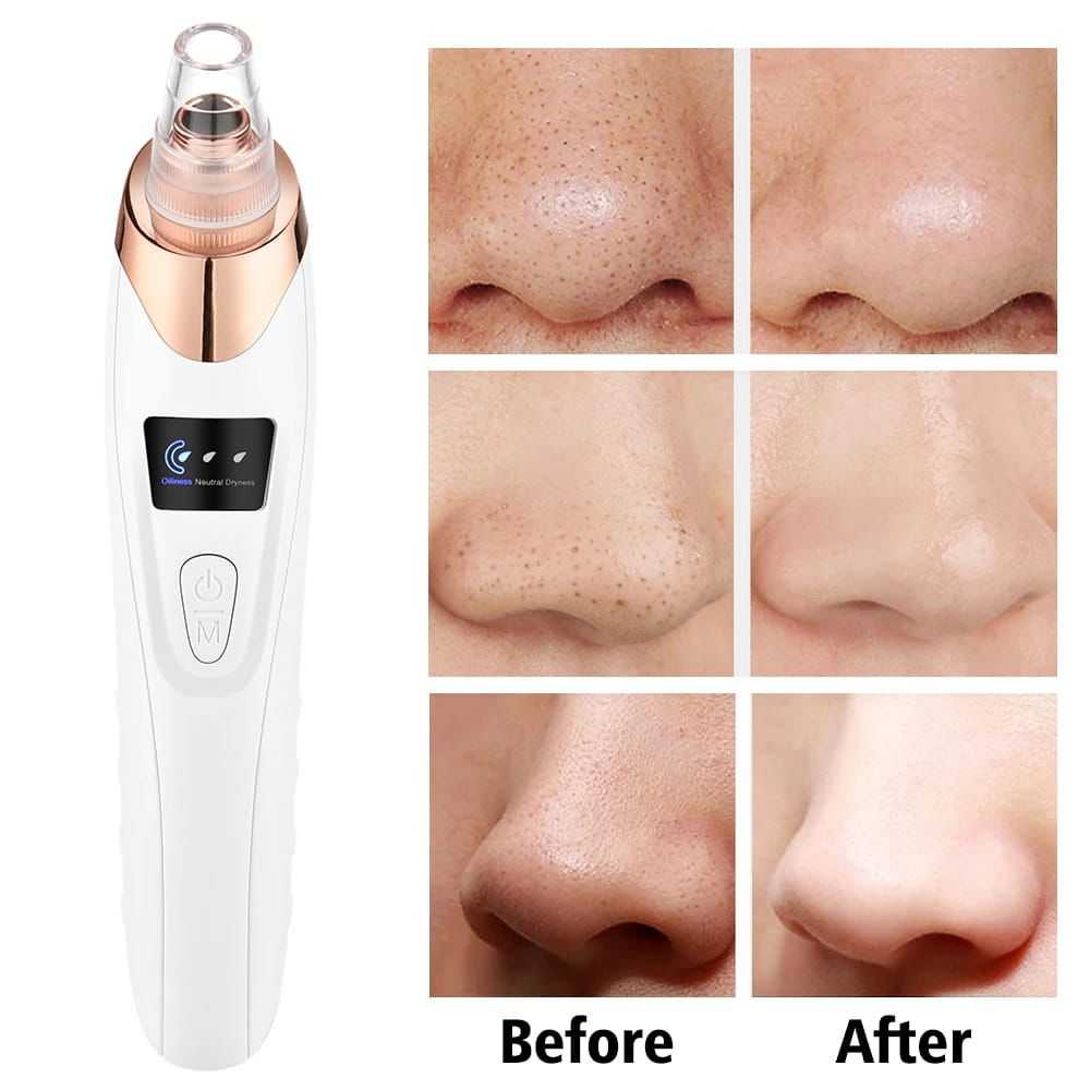 PoreVac Blackhead Remover